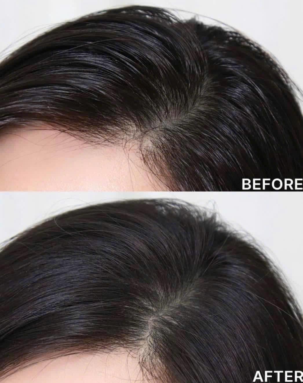 Thumb Bộ Sản Phẩm Chăm Sóc Tóc Aromatica Rosemary Scalp Scaling Trial Kit 4 món 