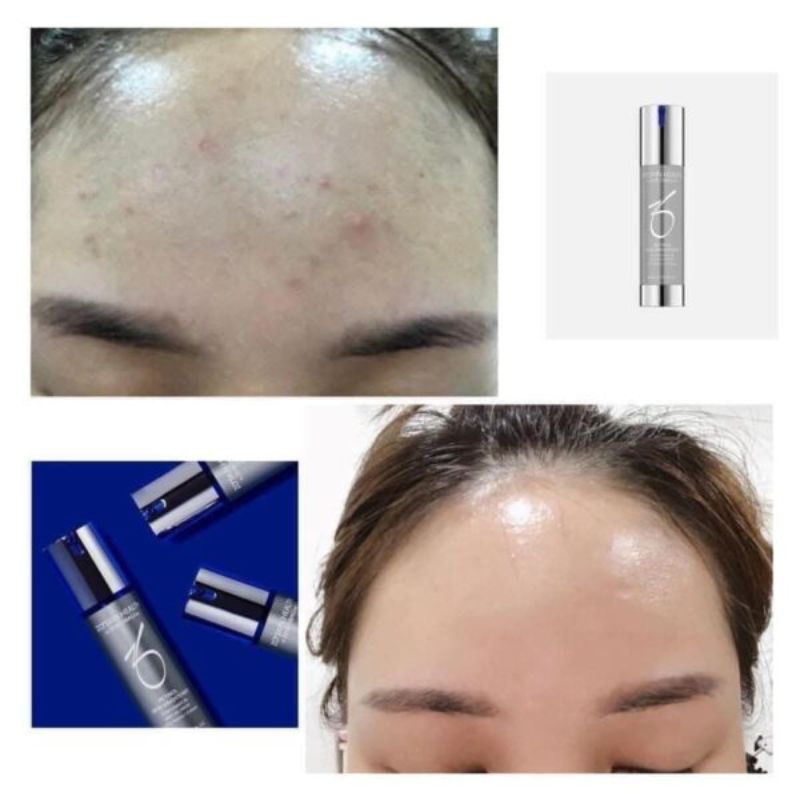 Thumb Kem dưỡng da Zo Skin Health Retinol Skin Brightener 50ml