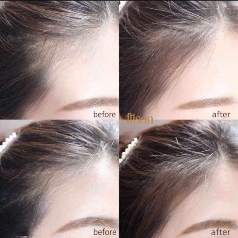 Thumb Phấn chấm hói Jenny House Self-up Hair Line Brush