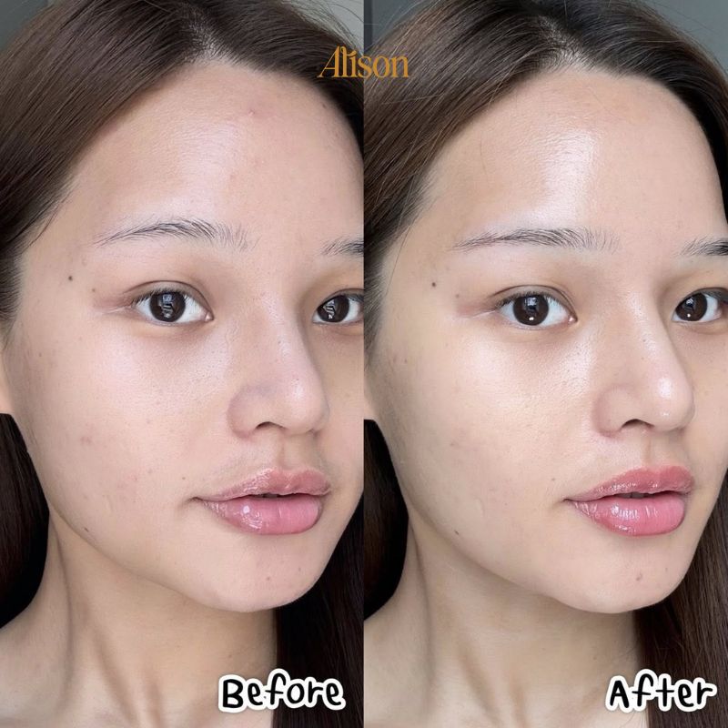 Thumb Gel Giảm Mụn Cerave Blemish Control Gel 40ml