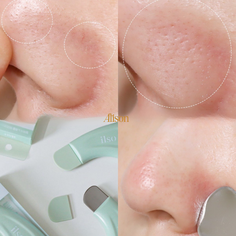 Thumb Thanh Đẩy Mụn Đầu Đen ILSO Deep Clean Master