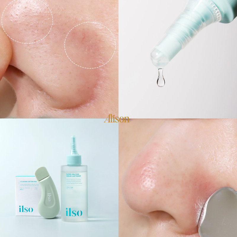 Thumb Tinh Chất Ủ Mụn Đầu Đen ILSO Super Melting Sebum Softener